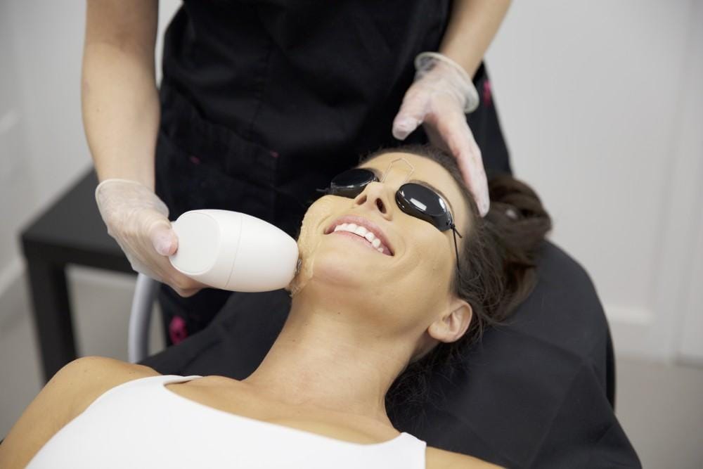 IPL Photofacial Treatment in Madisonville, LA