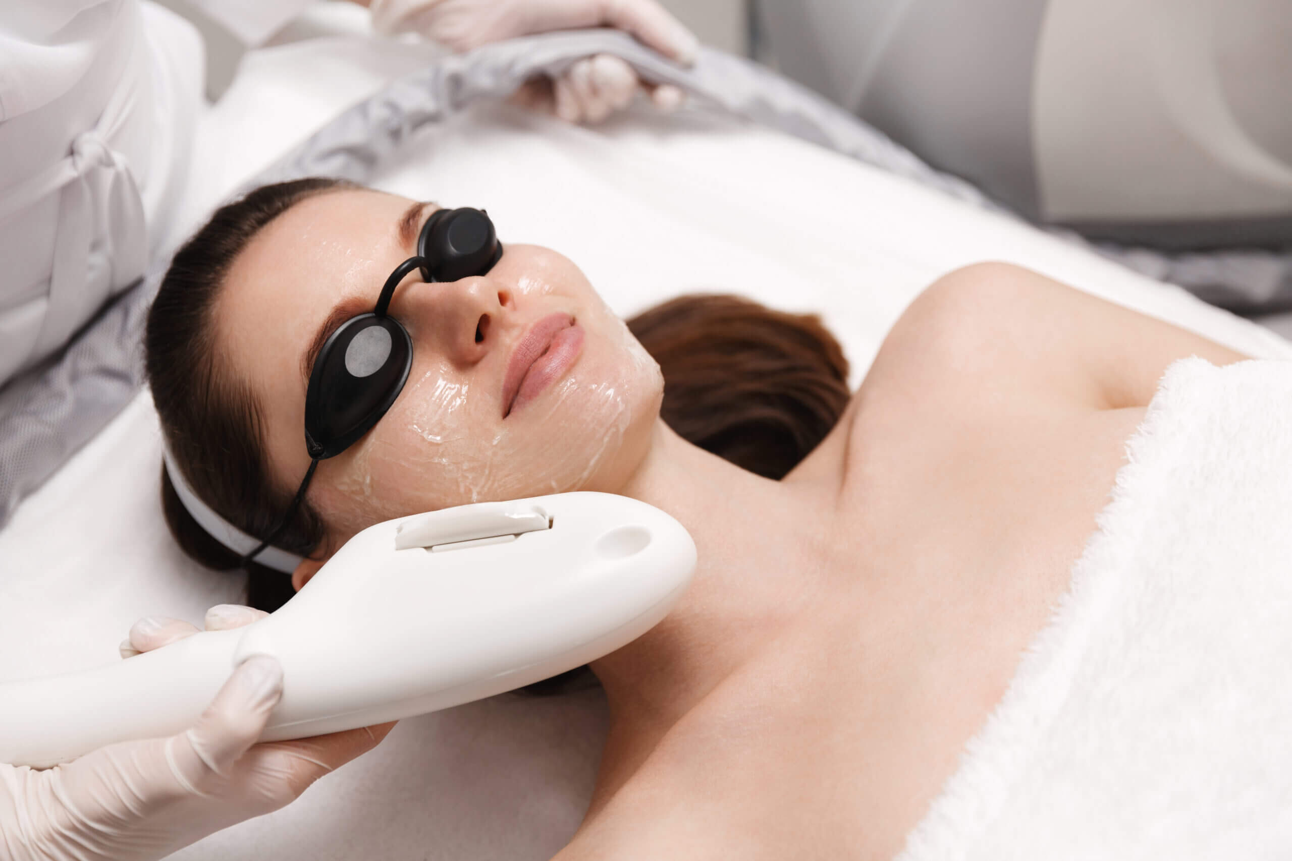 IPL Photofacial Say Goodbye to Skin Imperfections and Embrace Radiant Skin