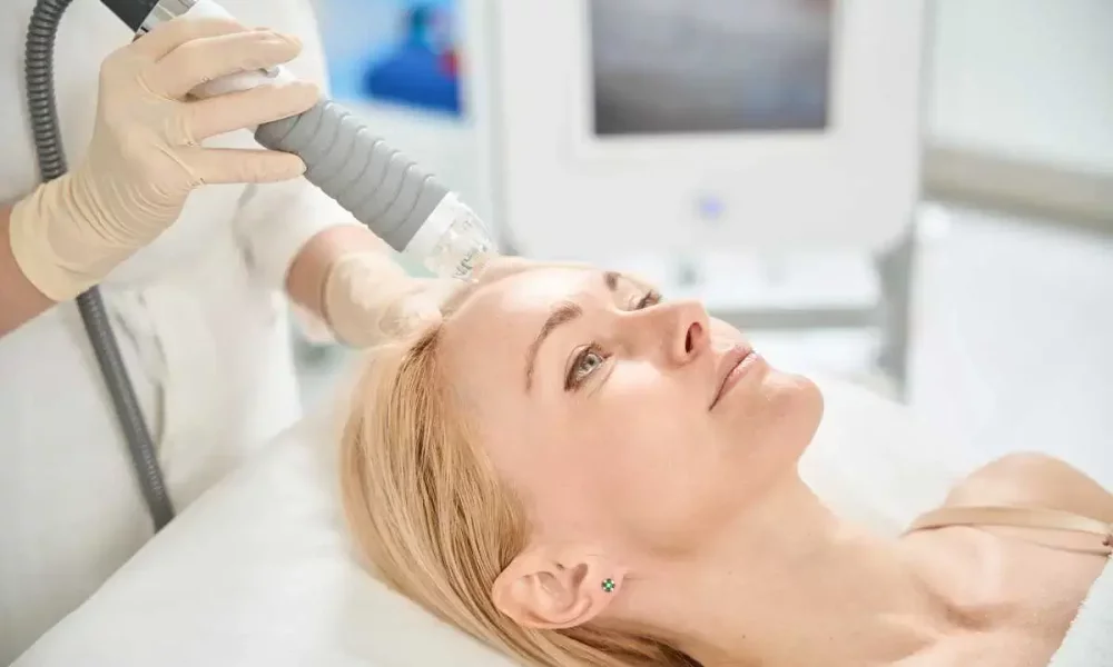 Morpheus8 RF Microneedling in Madisonville, LA